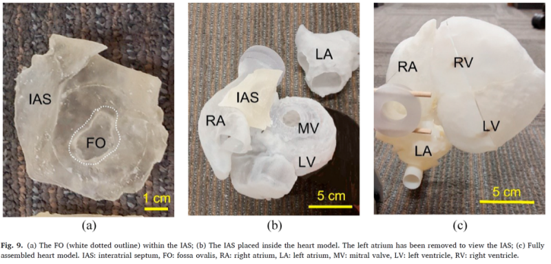 A figure consisting of three images.  On the left, a translucent white structure about 8cm by 8cm in size.  In the middle, the translucent structure is shown added to a white 3D model of a heart with a section missing.  On the right, the fully constructed model is shown, a white heart with the translucent tissue mimic attached.